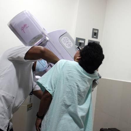 Pequeños pasos para cuidarte y reducir el riesgo de cáncer