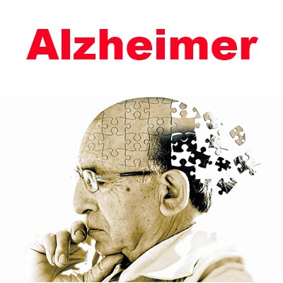 Científicos de Harvard descubren que la deficiencia de litio conduce a padecer Alzheimer