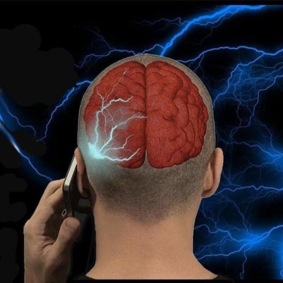 Desarrollan innovador tratamiento contra el cáncer cerebral