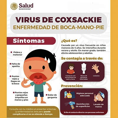 Estudiantes de diversos municipios presentan síntomas del virus Coxsackie